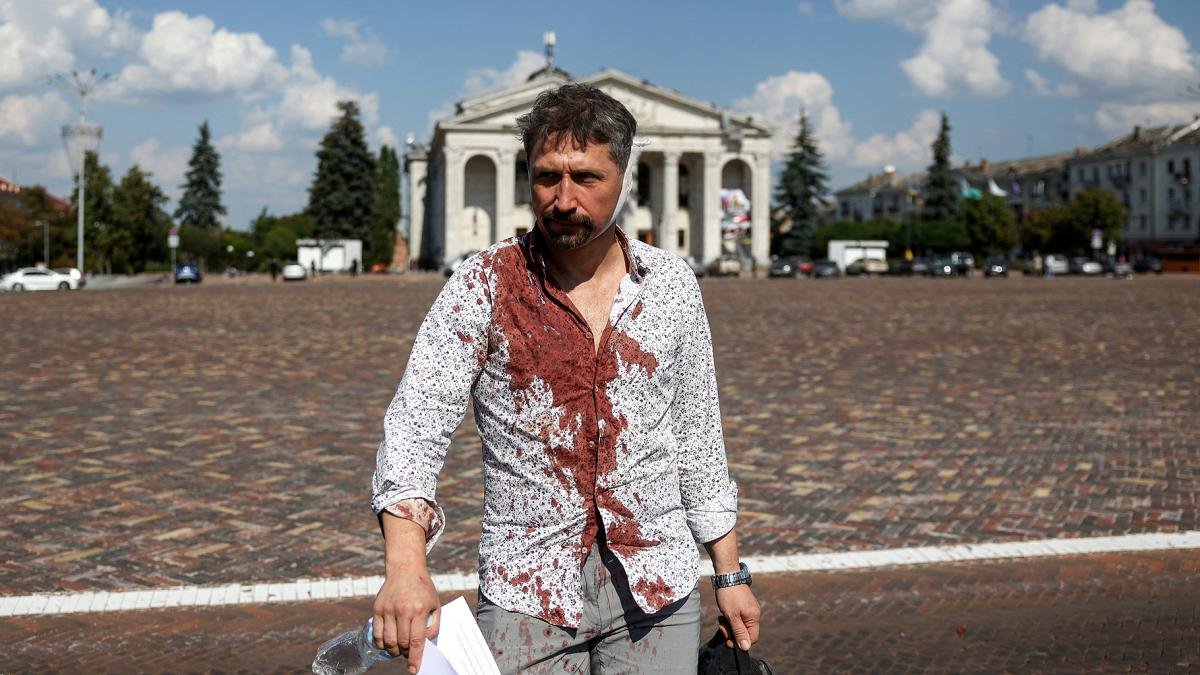 Tras el ataque 90 heridos pidieron asistencia mdica Foto AFP